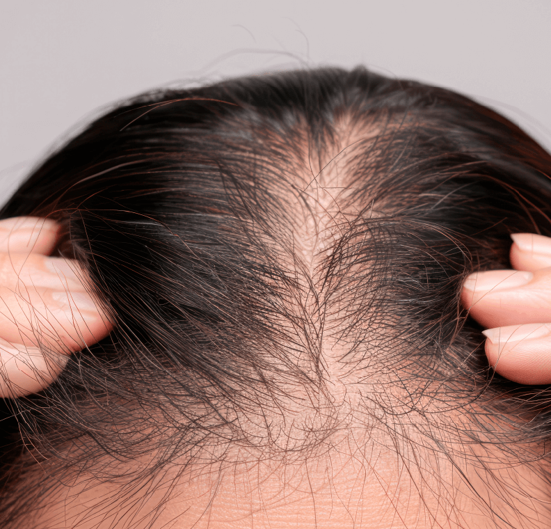 ダメージ毛イメージ画像